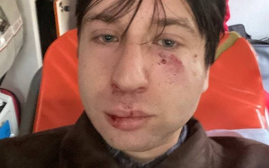 Историка и ветерана Владислава Стародубцева избили перед лекцией во Львове о левых движениях: полиция расследует хулиганство. ВИДЕО+ФОТО
